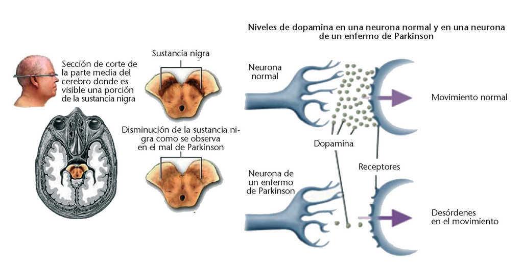 Neuronal